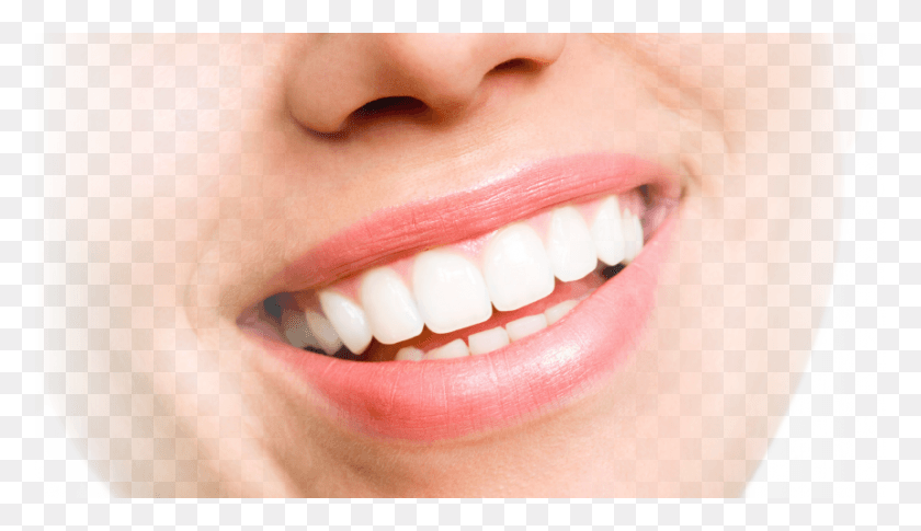 861x470 Beautiful Smile Philips, Teeth, Mouth, Lip HD PNG Download