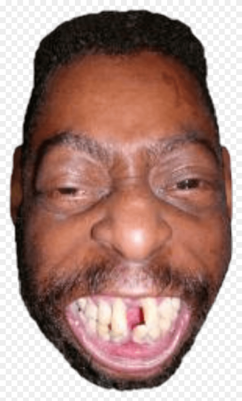 1024x1749 Черные Люди С Испорченными Зубами Ниггер С Испорченными Зубами, Голова, Лицо, Лицо Hd Png Скачать