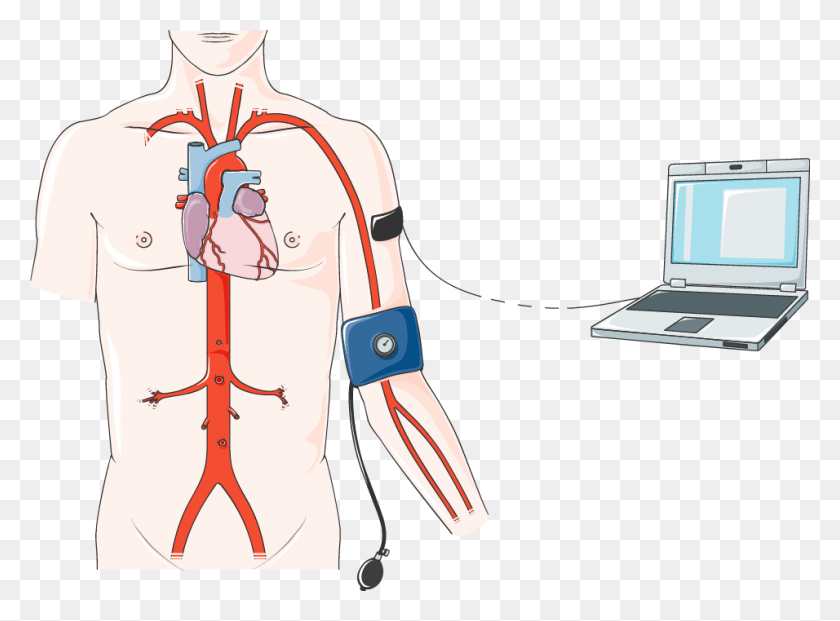 956x688 La Medición De La Presión Arterial Procedimiento De Cateterismo Cardíaco, Laptop, Pc, Computadora Hd Png