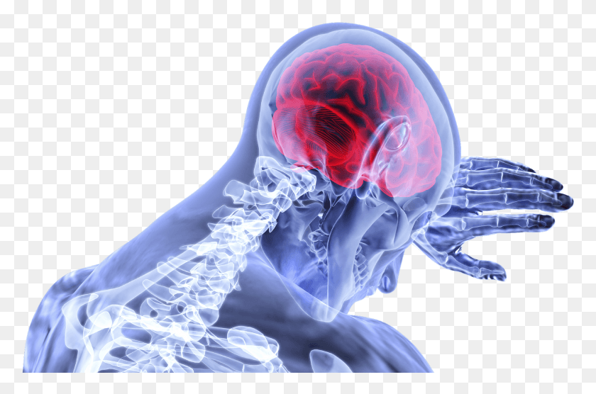 1756x1117 Мозг 3168269 Сотрясение Мозга, Рентген, Компьютерная Томография, Рентгеновская Пленка С Медицинской Визуализацией Hd Png Скачать