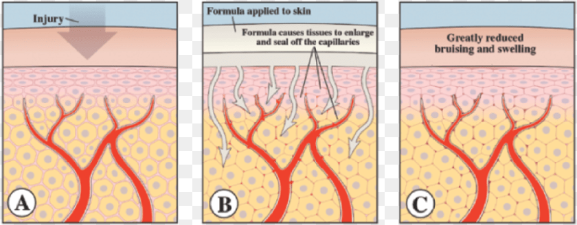 986x385 Bruise Repair Formula Bruises How They Are Formed, Book, Publication, Comics PNG