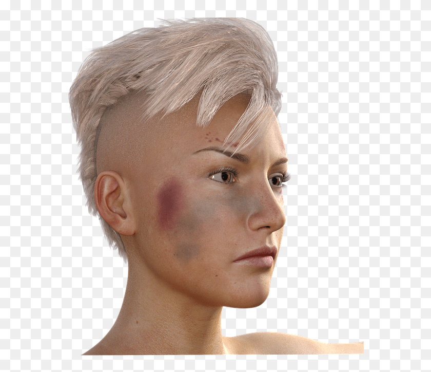 579x664 Bruised Jaw Female, Face, Person, Human HD PNG Download