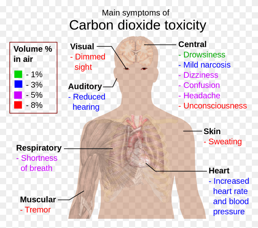 1176x1030 Carbon Dioxide Poisoning, Person, Human, Plot HD PNG Download