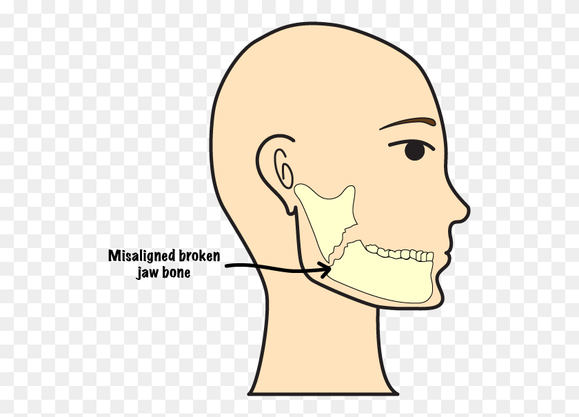 527x545 Cartoon, Head, Neck, Face HD PNG Download