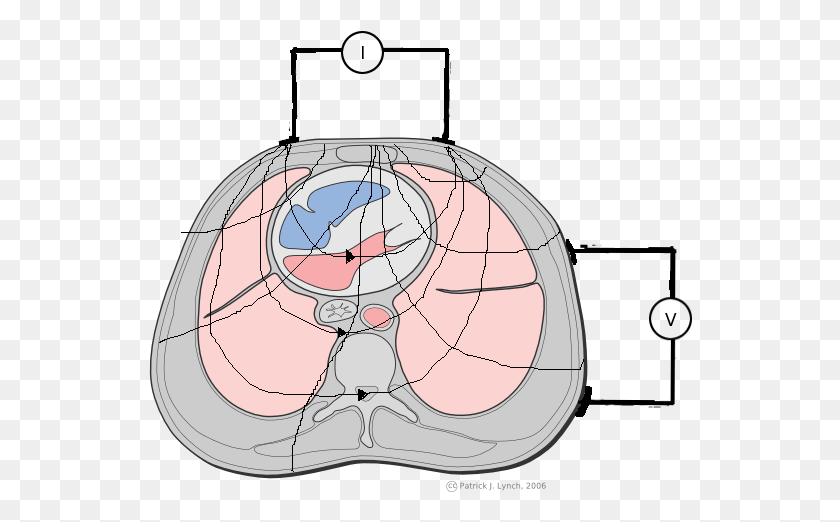 544x462 Chest Cross Section With Eit Electrodes Electrical Impedance Tomography, Sphere, Diagram, Plot HD PNG Download