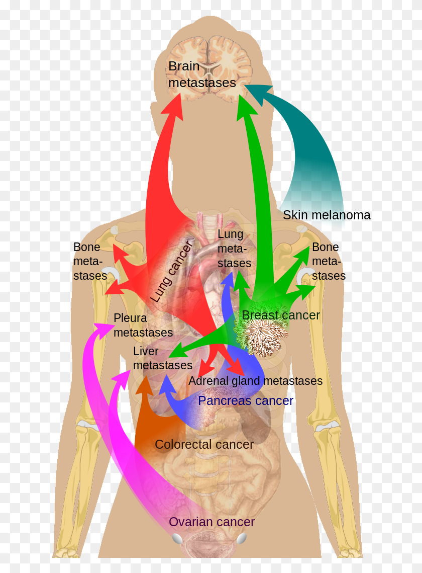 636x1079 Click Here Or Metastasis Sites, Poster, Advertisement, Flyer HD PNG Download