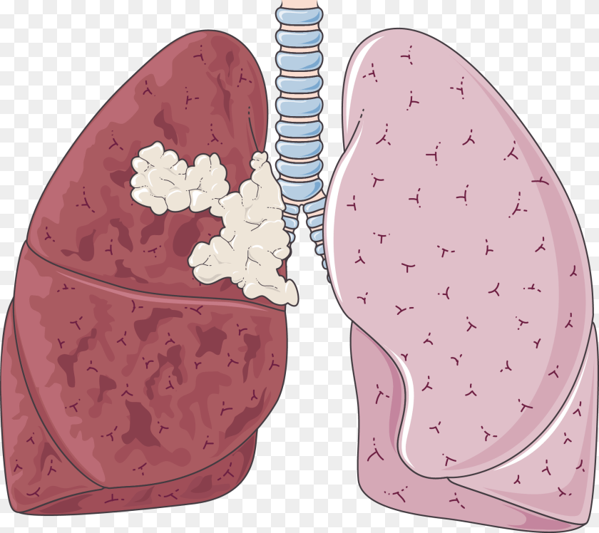 1898x1689 Clipart Library Clipart Lungs Milo Yiannopoulos Twitter Roasts, Clothing, Footwear, Shoe, High Heel Transparent PNG