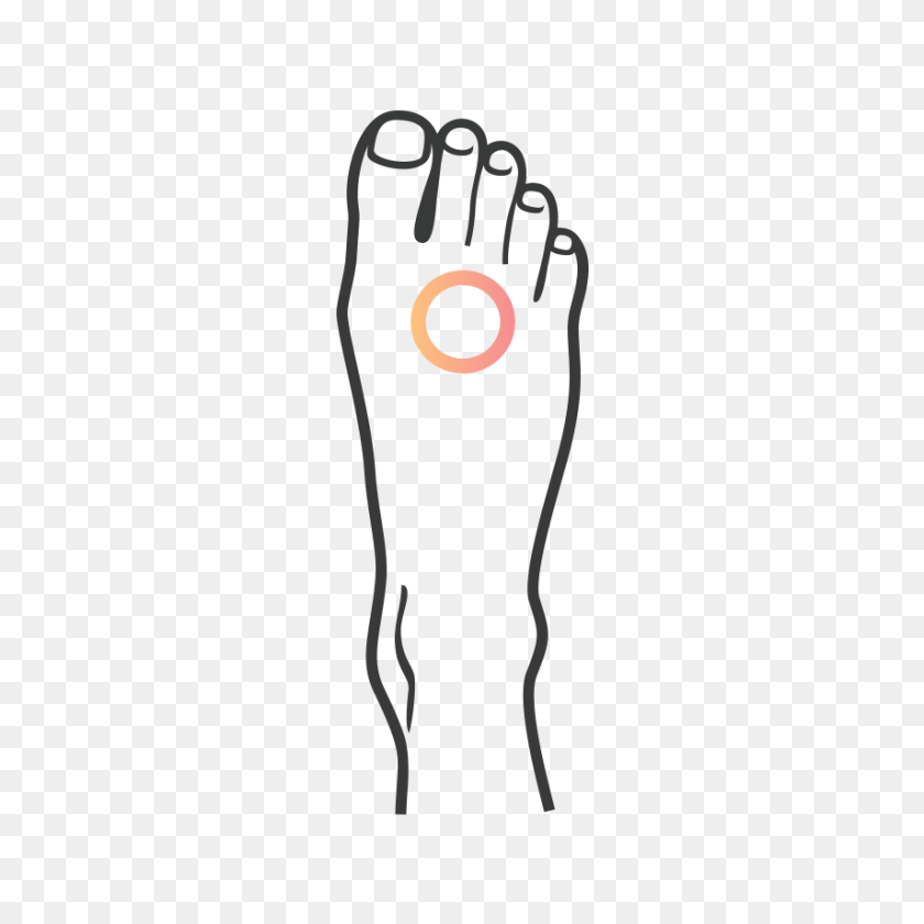 Custom Foot Orthotics Podiatrix, Body Part, Hand, Person, Animal PNG