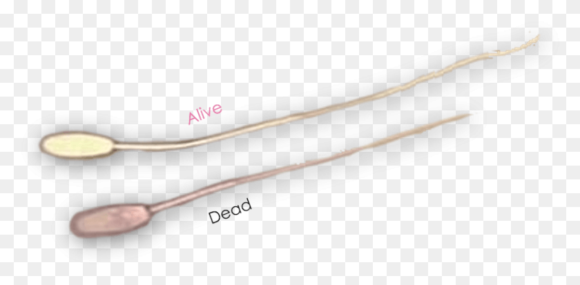 835x378 Dead Sperm Have A Toxic Effect On The Remaining Live Dead Sperm, Zipper, Text, Strap HD PNG Download
