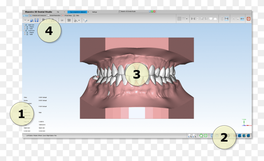 1024x598 Descargar Png Dental Studio Interfaz De Usuario 2 3D, Mandíbula, Dientes, Boca Hd Png