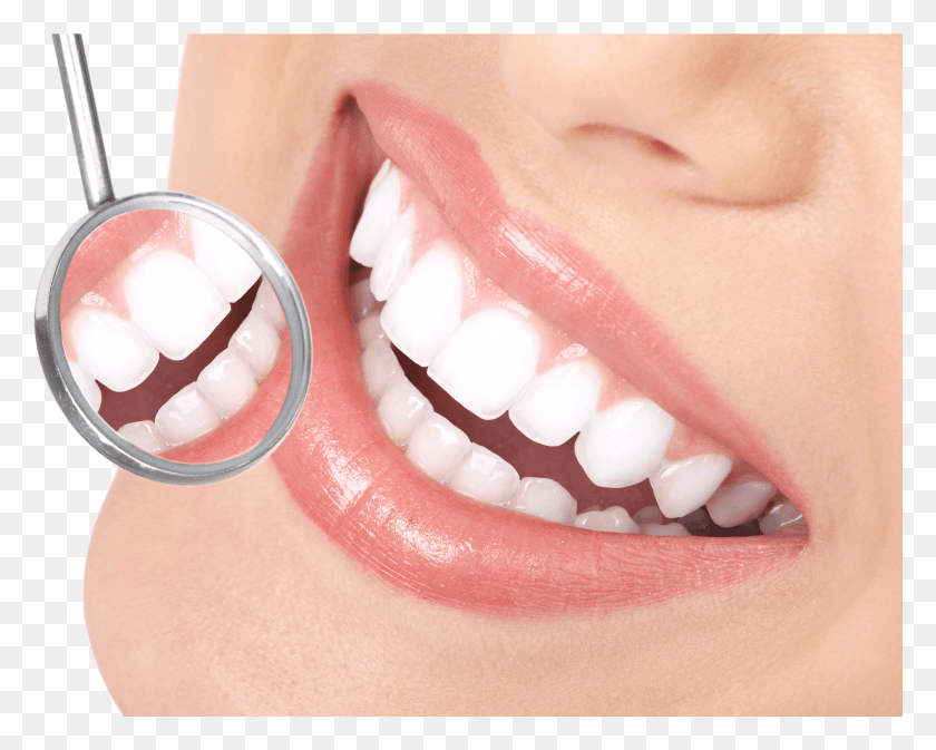 2333x1836 Зубные Виниры Улыбка Стоматологические, Зубы, Рот, Губа Hd Png Скачать