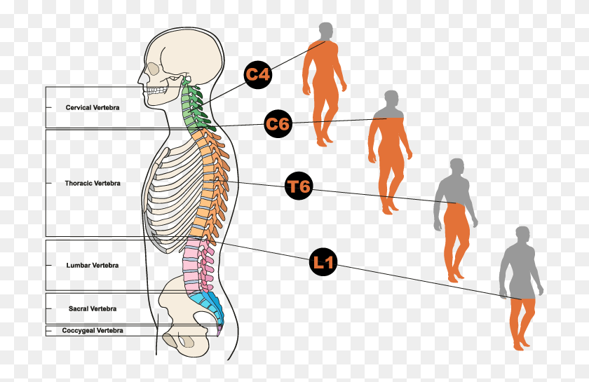 713x485 Diagram Showing Different Types Of Spinal Cord Injuries Illustration, Person, Human, Animal HD PNG Download