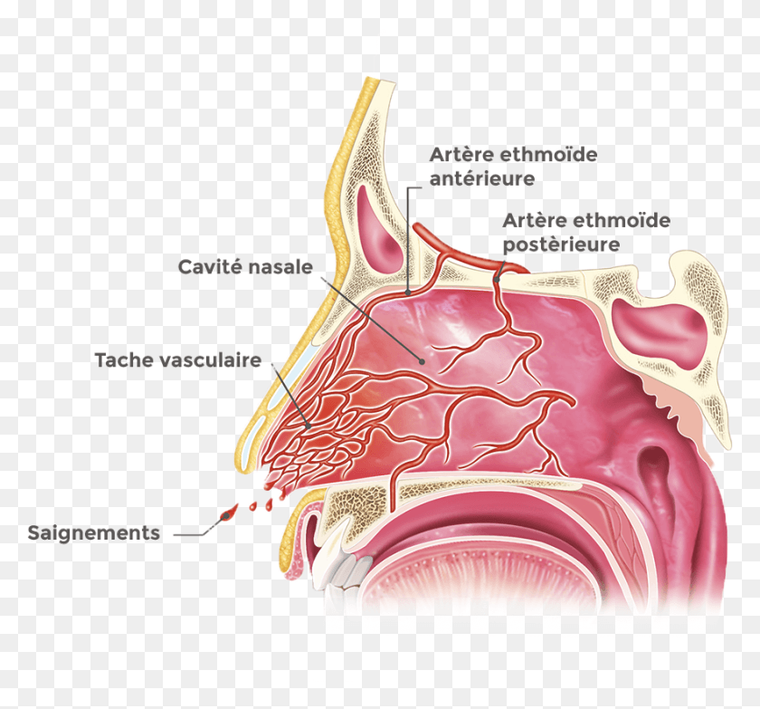 879x815 Dico 6 Tache Vasculaire, Stomach, Teeth, Mouth HD PNG Download