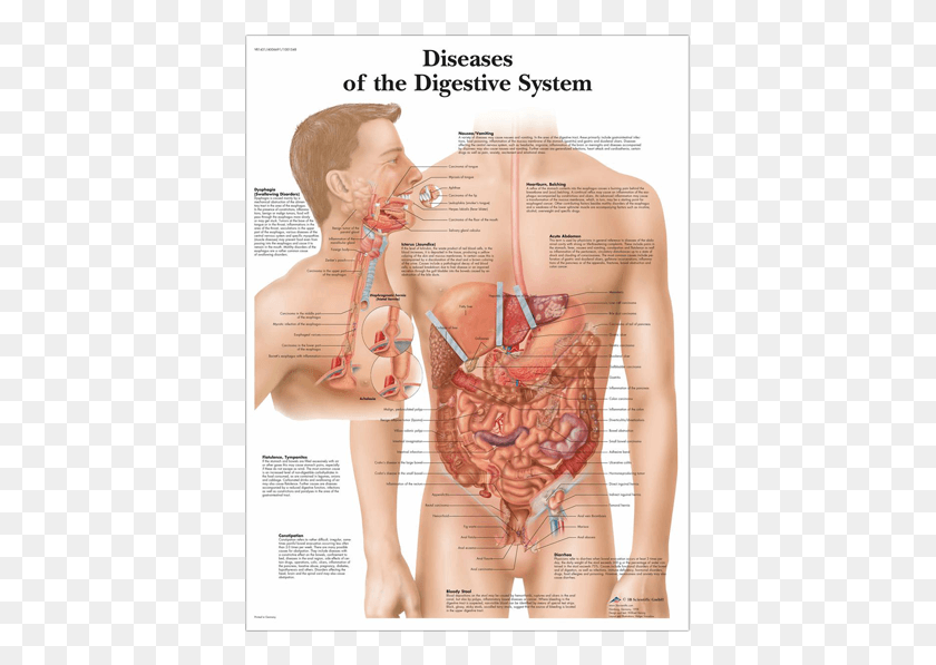 401x537 Enfermedades Del Sistema Digestivo, Persona Humana, Parcela Hd Png