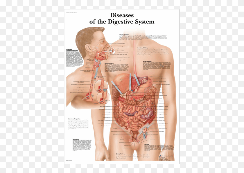 401x537 Заболевания Пищеварительной Системы, Человек, Человек, Участок Hd Png Скачать