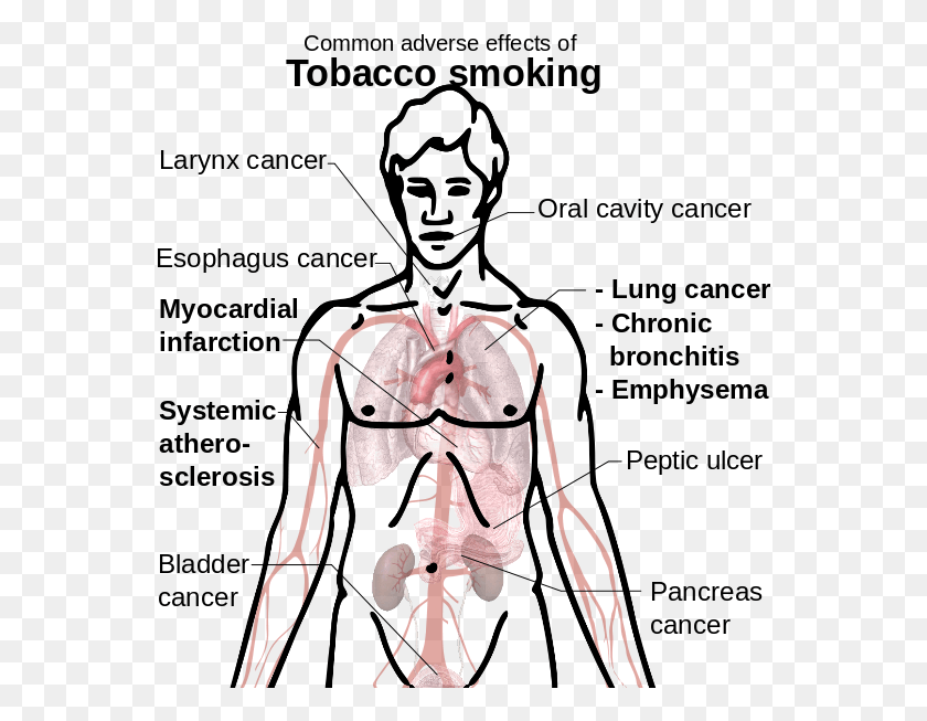 558x593 Descargar Png Efecto De Cigarrillo Dibujado Muestra De Tabaco Para Examen Neuro, Caballo, Mamífero, Animal Hd Png