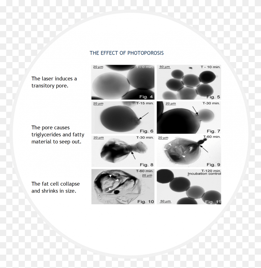 1475x1519 Effects Of Photoporosis Circle, Disk, X-ray, Ct Scan HD PNG Download