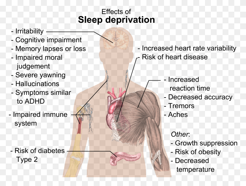 Effects Of Sleep Deprivation, Person, Human, Plot HD PNG Download