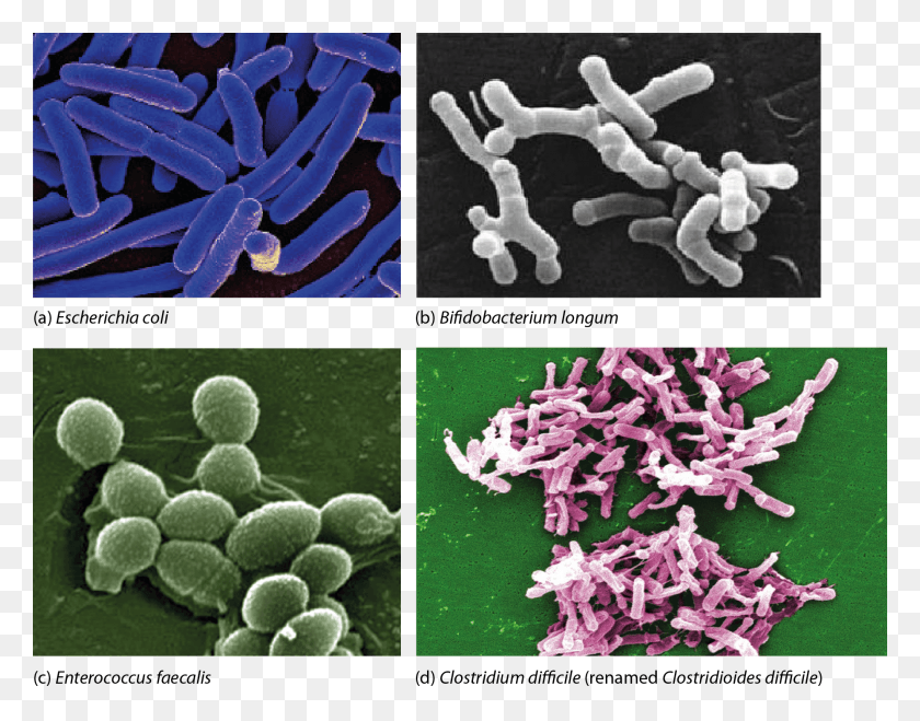 1857x1427 Electron Micrographs Of Bacteria Commonly Associated, Plant, Food HD PNG Download