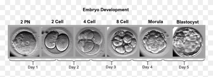 1025x322 Embryo Development Timeline Medical Imaging, X-ray, Medical Imaging X-ray Film, Ct Scan HD PNG Download