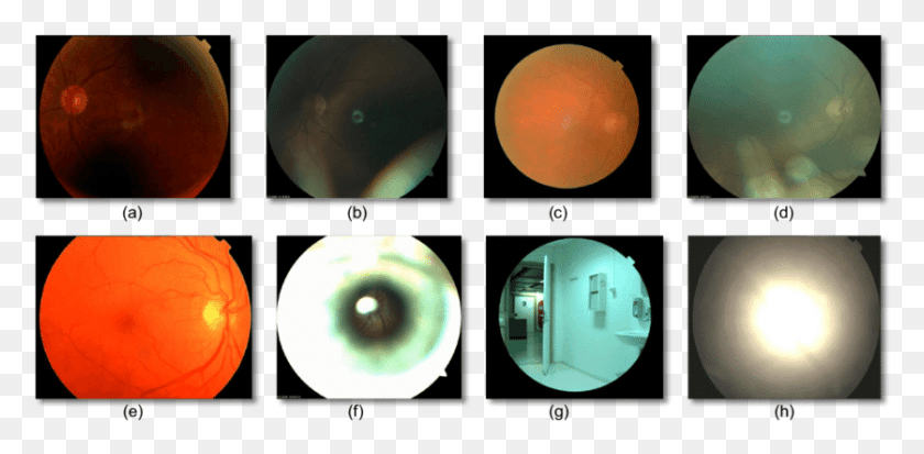 837x379 Examples Of Poor Quality Fundus Images Poor Quality Of Fundus, Sphere, Mouse, Hardware HD PNG Download