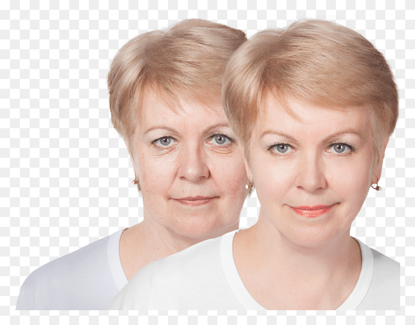1027x789 Facelift Mother, Face, Person, Head HD PNG Download
