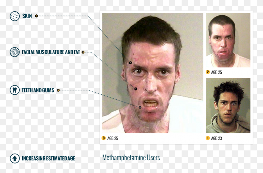 917x579 Faces Of Meth, Face, Person, Human HD PNG Download
