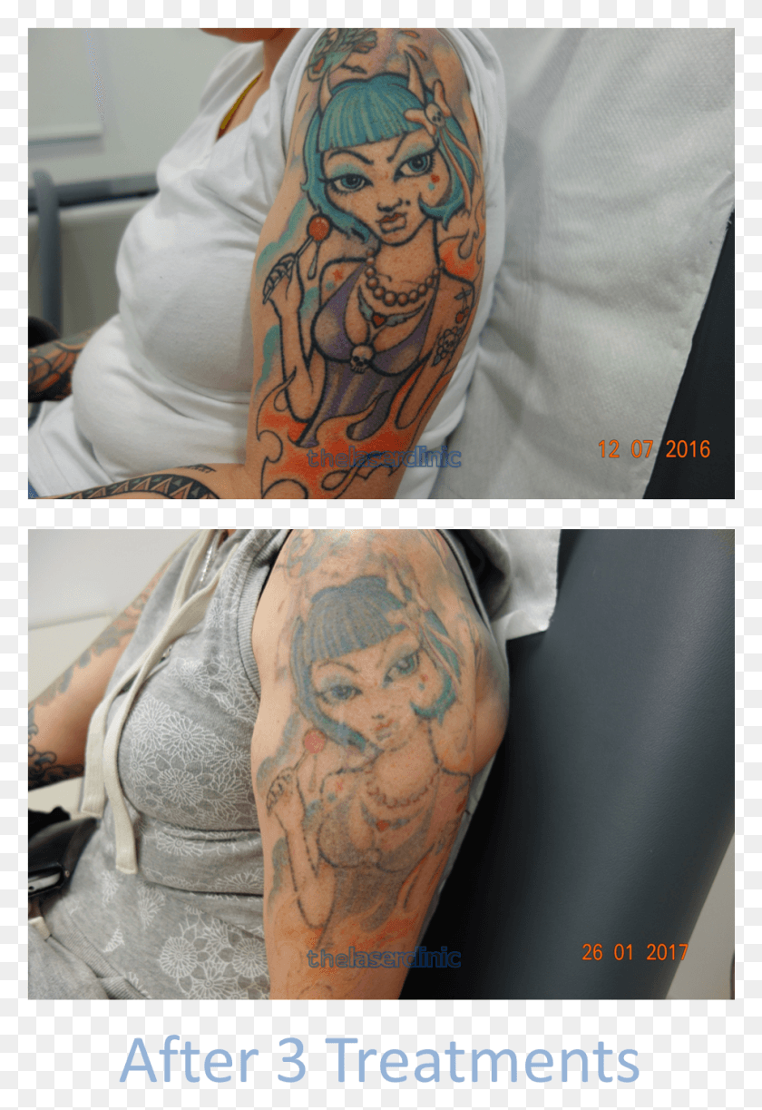 946x1411 Fading This Brightly Coloured Tattoo Required Only Bright Colour Tattoo Fade, Skin, Person, Human HD PNG Download