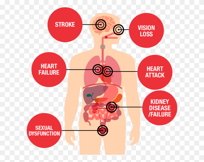 620x608 Fail Clipart Health Risk High Blood Pressure Effects, Plot, Diagram, Poster HD PNG Download