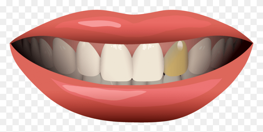 932x433 Colmillo, Dientes, Boca, Labio Hd Png