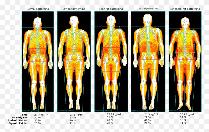 1349x817 Fat Person Illustration, Human, Skeleton, Neck HD PNG Download