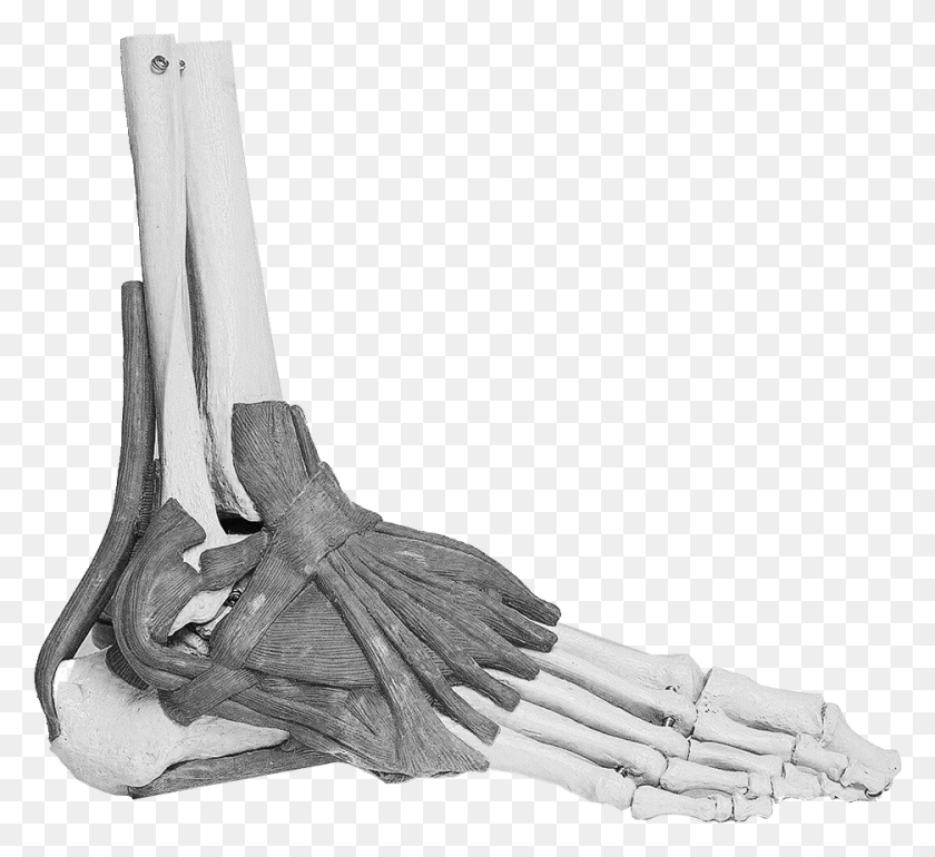 936x853 Feet Sinus Tarsi Syndrome, Axe, Tool, X-ray HD PNG Download