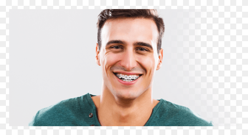 875x448 Fixed Appliances Adult Braces, Smile, Face, Person HD PNG Download