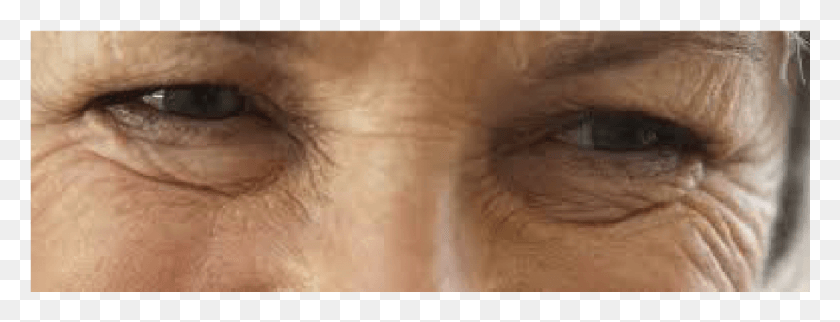 1044x352 For Fine Lines Deep Wrinkles Improvement In Texture Close Up, Neck, Skin HD PNG Download