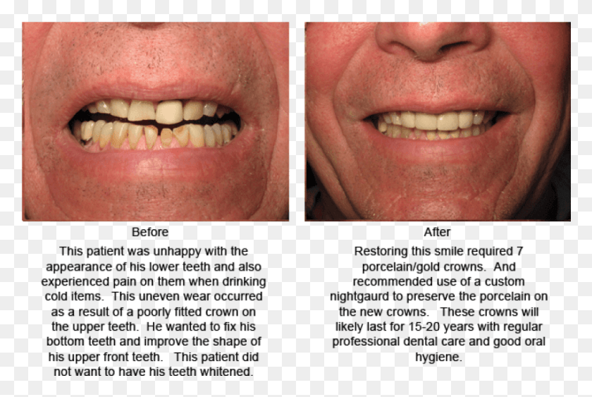 851x549 Free Aggression Images Background Good Teeth Shape, Mouth, Lip, Person HD PNG Download