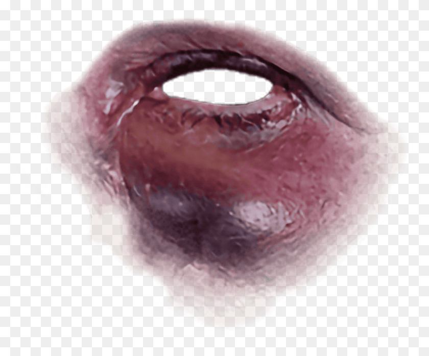 844x690 Free Black Eye Bruise Images Background Bruise Black Eye, Fungus, Crystal, Accessories HD PNG Download