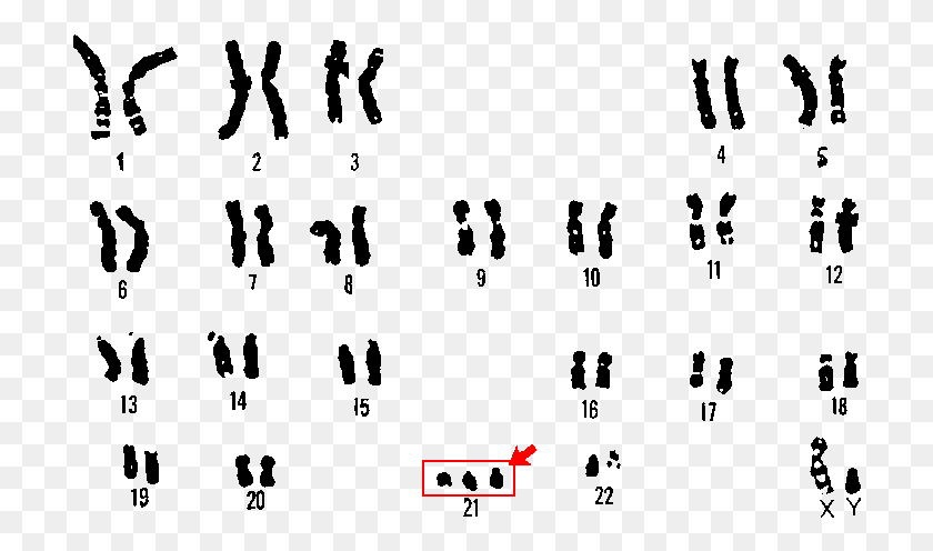 710x436 Freeuse Aneuploidy Chromosomal Rearrangements Down Syndrome Genome, Outdoors, Text, Nature HD PNG Download