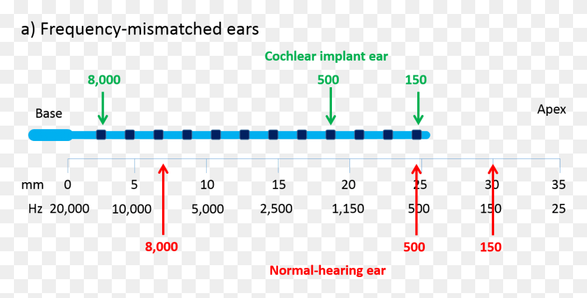 1425x672 Frequency Mismatch Could Make It Difficult For People Cochlear Implant Frequency, Plot, Text, Diagram HD PNG Download