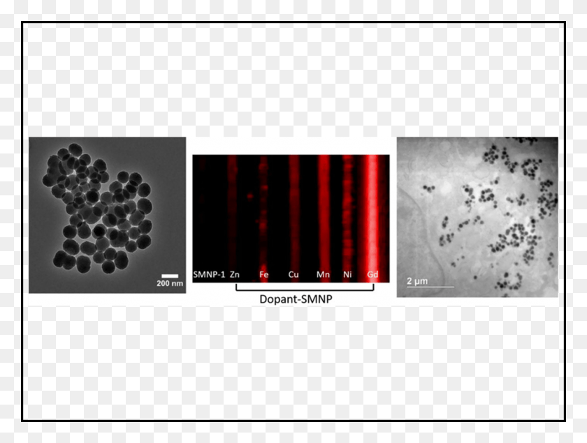 1224x903 Gadolinium Doping Enhances The Photoacoustic Signal Blackberry, X-ray, Ct Scan, Medical Imaging X-ray Film HD PNG Download