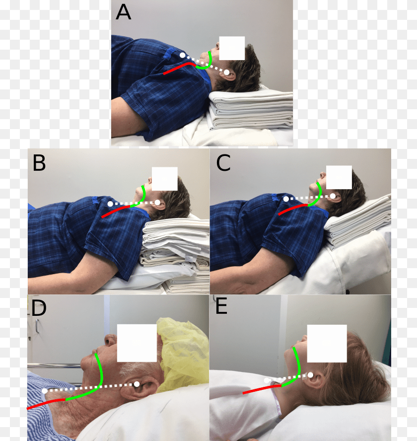 Greenland On Positioning Bedroom, Person, Patient, Adult, Baby Clipart PNG