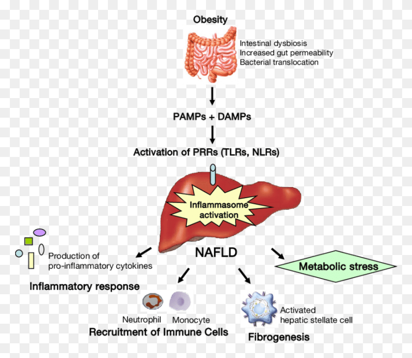 851x731 Gut Liver Interactions During Nafld Progression Gut Microbiota And Nafld, Interior Design, Indoors, Teeth HD PNG Download