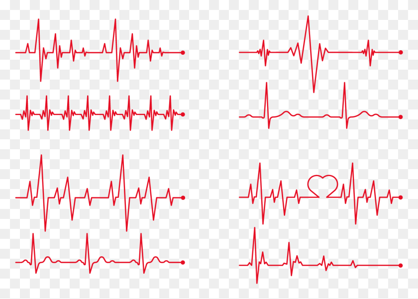 1382x960 Heart Rate Electrocardiography Clip Art Free Vector Heart Beat, Text, Plot, Pattern HD PNG Download
