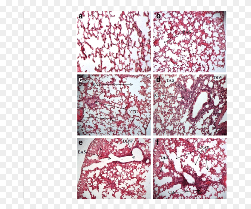 683x637 Histological Section Of Lung Tissue Of Mice Inhaled Motif, Rug, Paper, Interior Design HD PNG Download