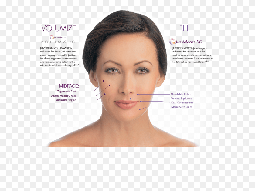 1244x910 How Bruise Juvederm Submalar Injections, Person, Human, Head HD PNG Download