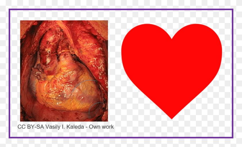 880x509 How Does The Work Science Made Simple Does A Heart Look Like, Food HD PNG Download