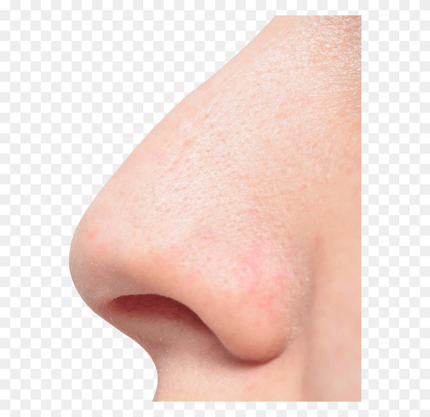 572x754 Human Nose Freckle, Skin, Person, Neck HD PNG Download