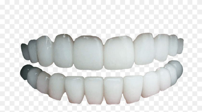 740x406 Human Teeth No Gums Transparent Background Teeth, Mouth, Lip, Pill HD PNG Download