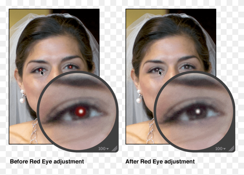 796x554 Image Before And After A Red Eye Adjustment Eye Liner, Person, Human, Face HD PNG Download
