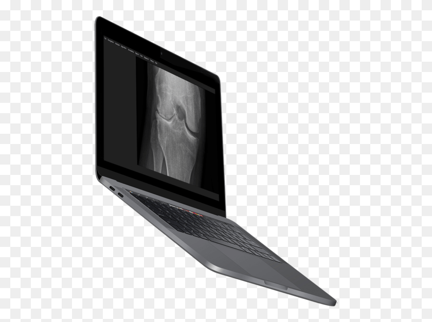 475x566 Image Biopsy Lab Software Laptop Output Device, Pc, Computer, Electronics HD PNG Download