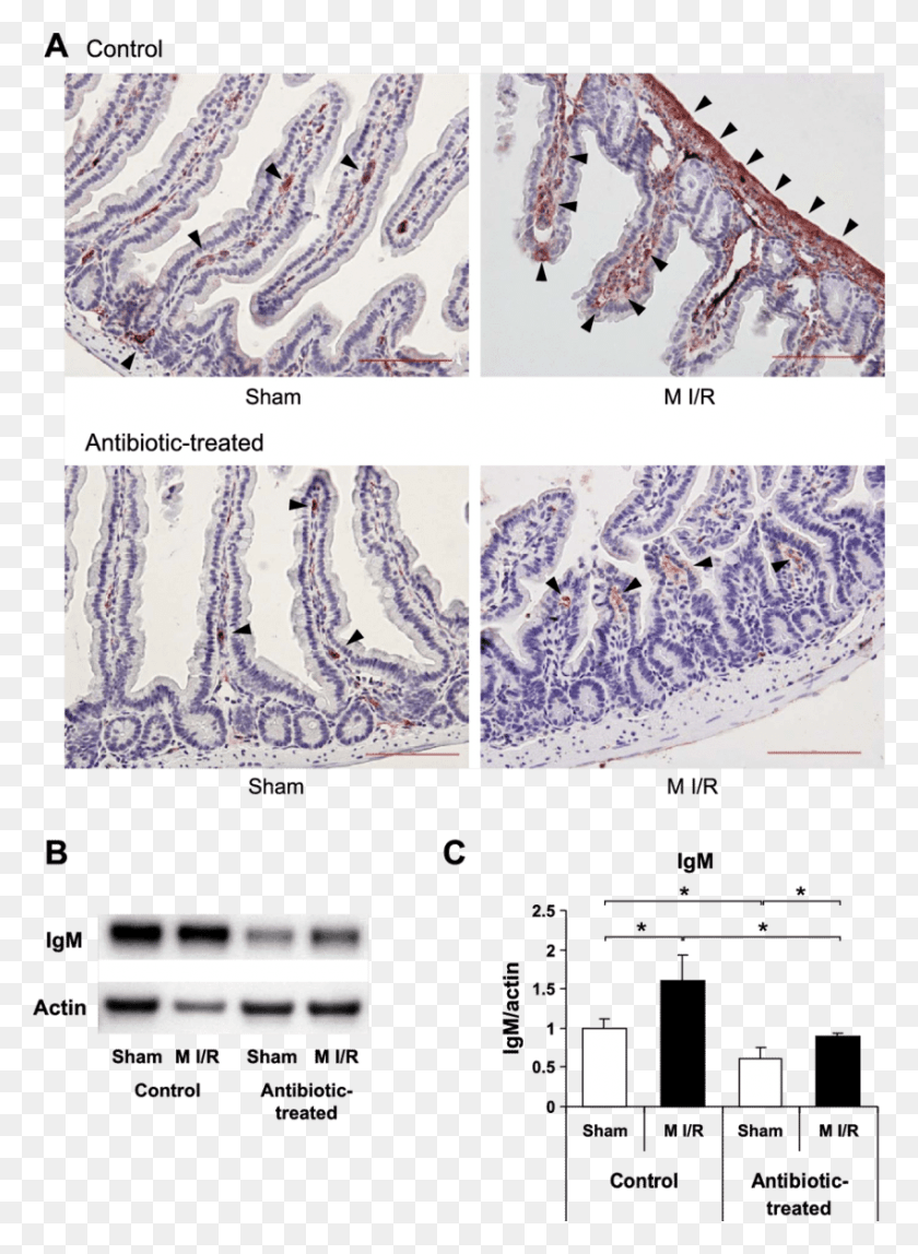 850x1186 Immunoglobulin M Deposition In Small Intestine Following Parallel, Bird, Animal, Plot HD PNG Download